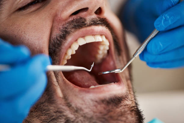 Best Emergency Dental Services for Seniors in Bethel Manor, VA